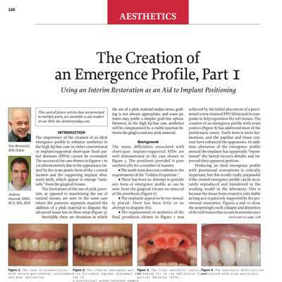 The Creation of an Emergence Profile Part 1 – Using an Interim Restoration as an Aid to Implant Positioning