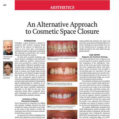 An Alternative Approach to Cosmetic Space Closure