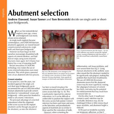 Abutment Selection