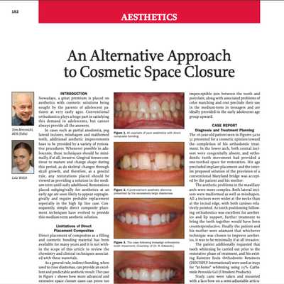 An Alternative Approach to Cosmetic Space Closure