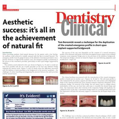 Aesthetic Success – It’s All In The Achievement of a Natural Fit