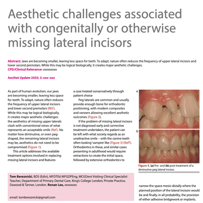 Aesthetic challenges associated with congenitally or otherwise missing lateral incisors