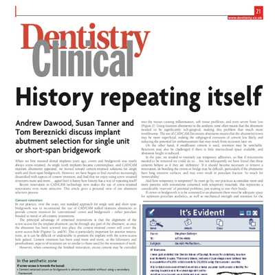 History Repeating Itself – Implant Abutment selection in Single unit and Short Span Bridgework