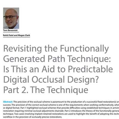 Revisiting the Functionally Generated Path Technique: Is This an Aid to Predictable Digital Occlusal Design? Part 2. The Technique